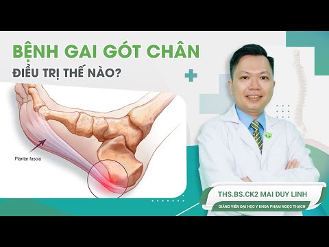Video: Cách chẩn đoán gai gót chân: 5 triệu chứng chính + Mẹo giảm đau nhanh