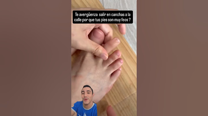 Do you have ugly feet? Watch this video #viral #foryou #feet #uglyfeet #fyp #viralvideo