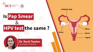 HPV Test & Pap Smear Test | Cervical cancer Detection | SCI Hospital