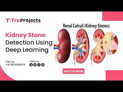 Kidney stone detection using deep learning