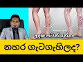 varicose veins & Spider veins  By Nutritionist Hiroshan Jayaranga