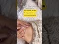 Having pain in knee #dryneedling #youtube #viral #pain #physiotherapy #treatment #kneepain #shorts