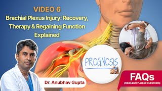Brachial Plexus Injury Recovery: Time, Therapy, Prognosis & Full Function Explained Wealth