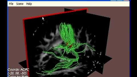 Dynamic regions of interest in DTI-Query