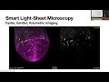 Navigate: Advancing cancer biology with autonomous light-sheet microscopy