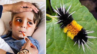 This Caterpillar Looks Innocent, But It Hospitalized This 4YearOld With One Touch