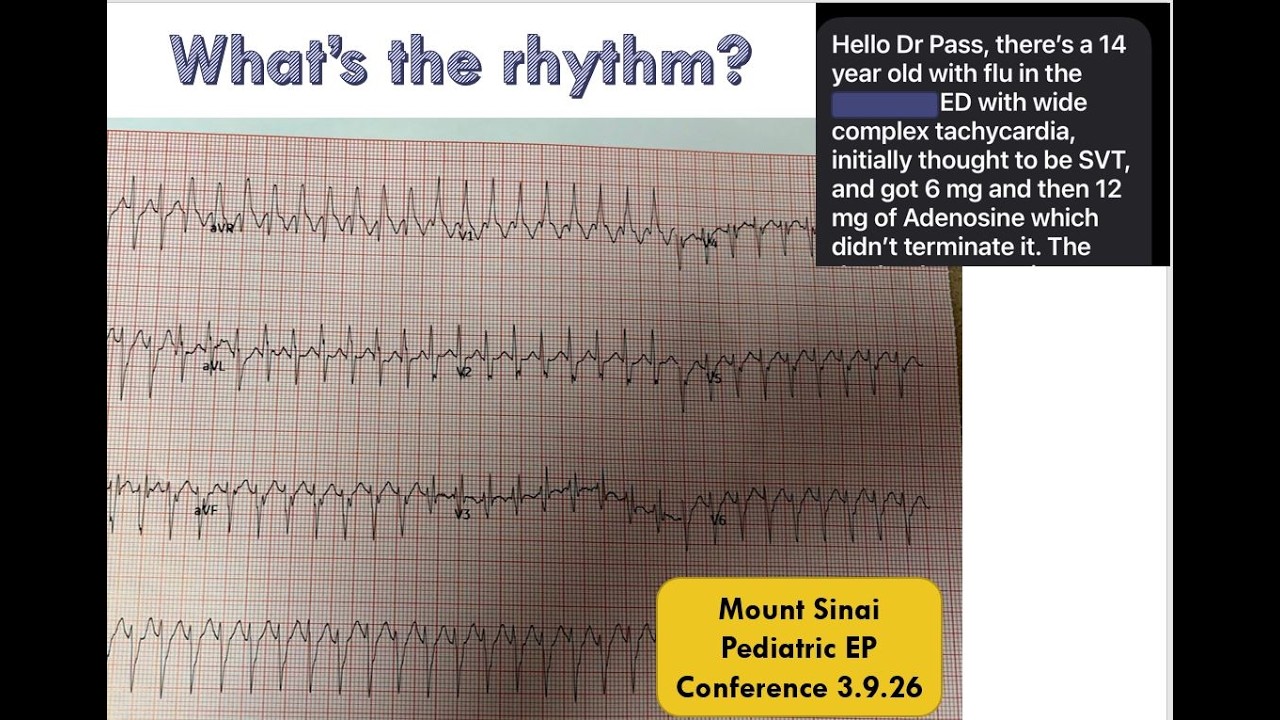 Mount Sinai Pediatric EP Conference 3.9.26