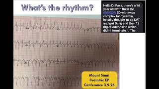 Mount Sinai Pediatric EP Conference 3.9.26