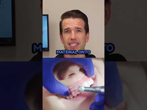 वीडियो: बिना ब्रेसेस के अपने दांतों को कैसे सीधा करें (चित्रों के साथ)