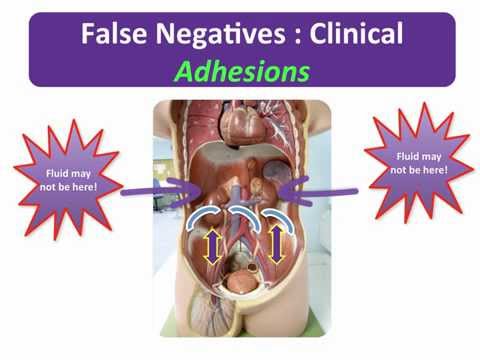 Image of FAST II - Potential Pitfalls
