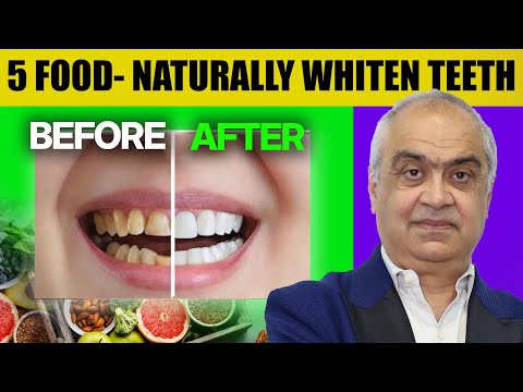 5 Natural Foods That Whiten Your Teeth Fast