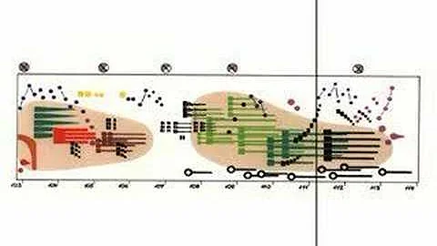 Ligeti - Artikulation