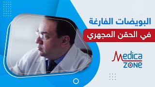 علاج البويضات الفارغة في الحقن المجهري | دكتور خالد عبدالملك | Medicazone