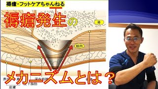 褥瘡を基礎から学ぶ！！　褥瘡発生のメカニズムとは？