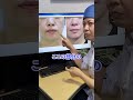 【口元が劇的に若返る】マリオネットラインを消す方法 #shorts