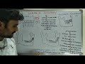 Subapical osteotomy