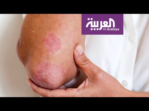 فيديو: مجموعات زهرة قوس قزح في صور إميلي بلنكوي