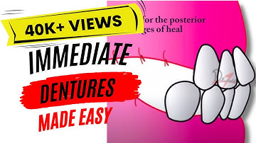 Immediate dentures | Clinical Steps