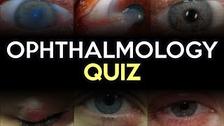 Ophthalmology Quiz