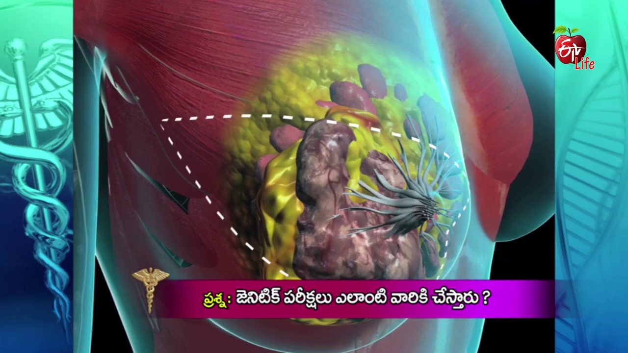 Dr. ETV | Whom do you suggest for Genetic test ? | 19th June 2017 | డాక్టర్ ఈటివీ