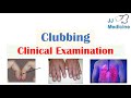 Clubbing (Fingers & Toes) | Causes, Schamroth’s Sign, Associated Conditions, Treatment