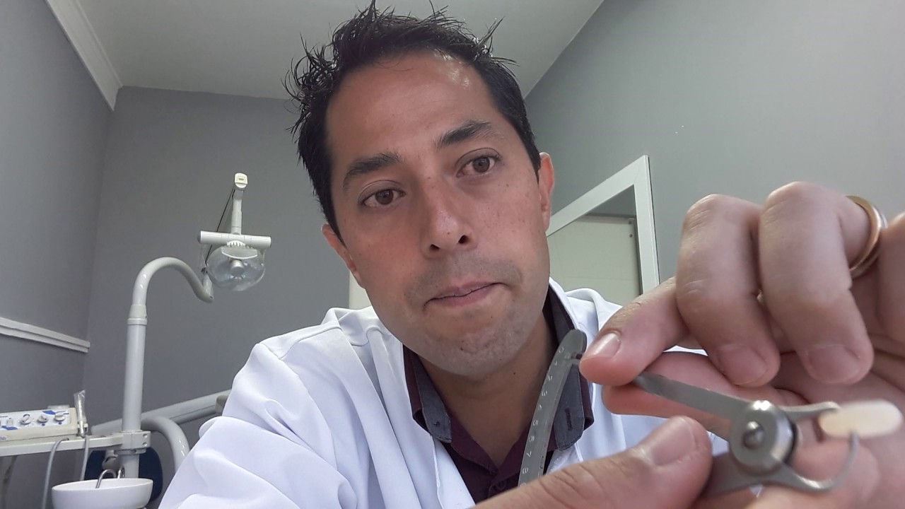 Lentes de Contato Dentais X Facetas