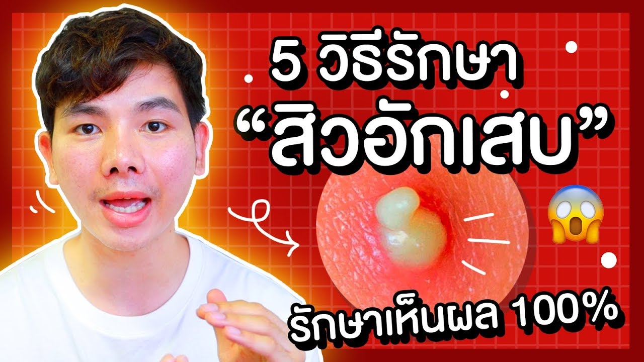 5 วิธีรักษาสิวอักเสบ สิวหัวหนอง รักษายังไงให้หายเร็ว หายขาด !! | นุชา HAPPY NUCHA | อาหาร ลด สิว อักเสบเนื้อหาที่เกี่ยวข้องที่แม่นยำที่สุด