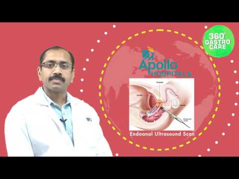 Anal Fistula: Symptoms & Treatment- Apollo Health City