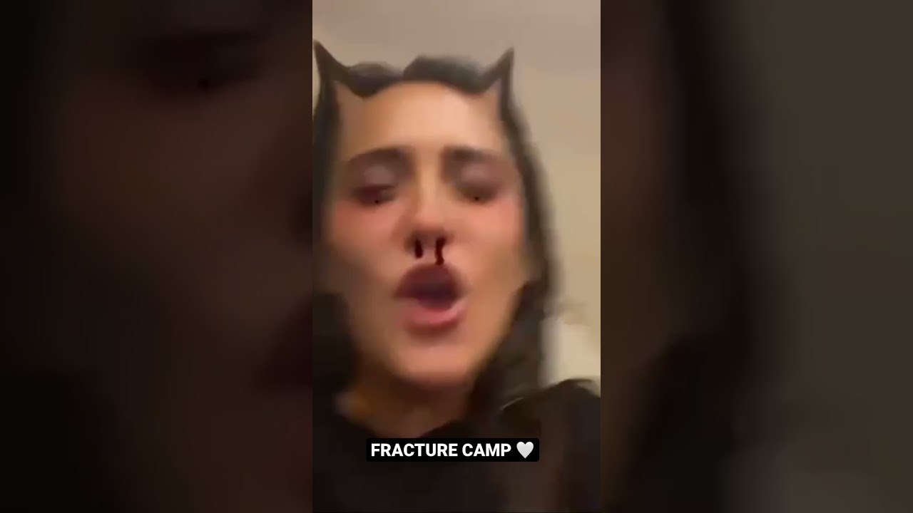 JESSE JO STARK - FRACTURE SERIES X BALMAIN