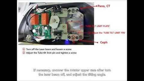 Scan ceph Alignment tutorial on RAYCAN Alpha