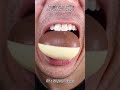 Satisfying Chewing ASMR #Compilation #ASMR #DoctorTristanPeh