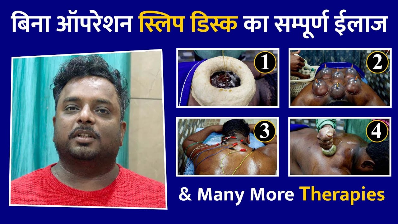बिना ऑपरेशन L4 L5 S1 स्लिप डिस्क का सम्पूर्ण ईलाज | Manglam Kayakalp Hospital Sikar