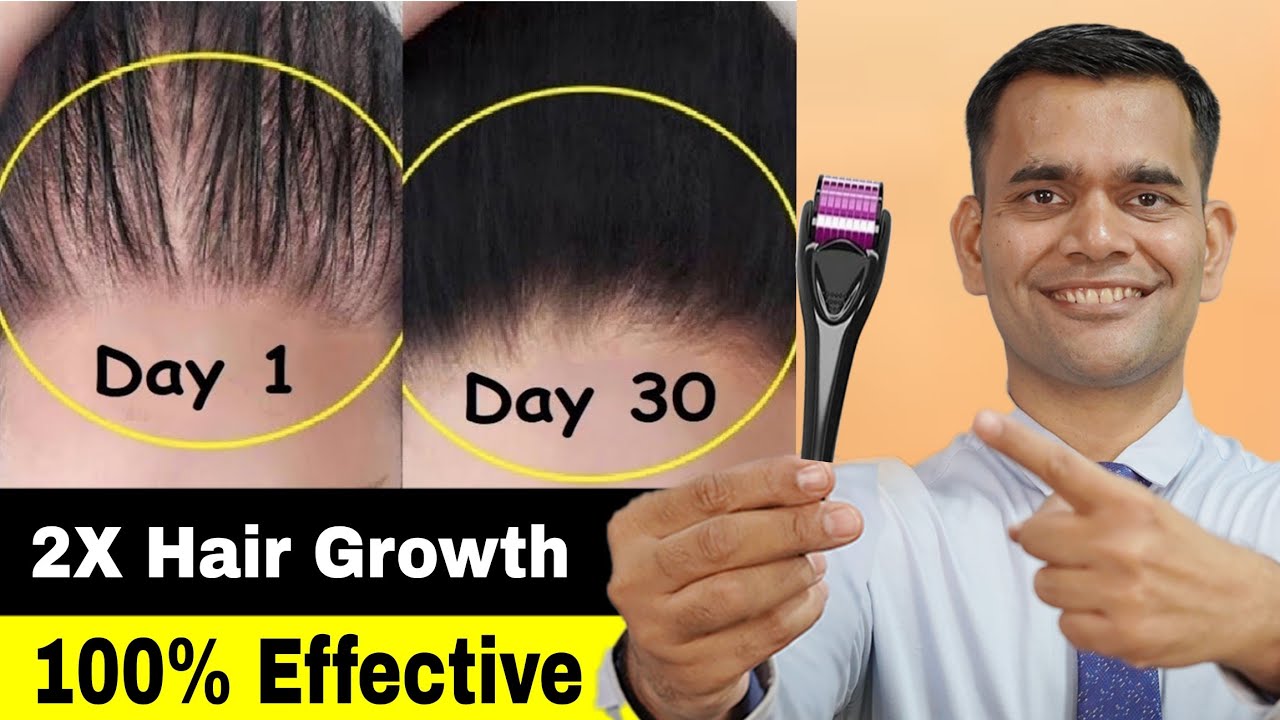 Try This For 2x Hair Growth At Home
