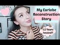 My Earlobe Reconstruction Story! 1.5 Years Healed!