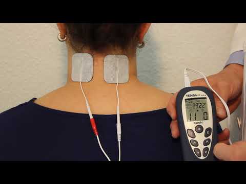 Elektrotherapie: Small Fiber Matrix Stimulation vs Transkutane Elektrische Nervenstimulation (TENS)