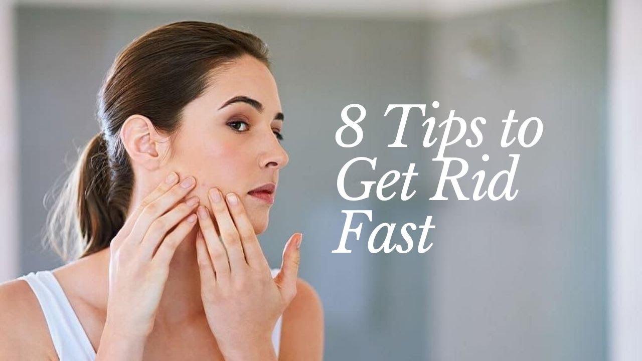 How To Get Rid Of Pimples Fast | 8 Tips to Get Rid Fast - YouTube