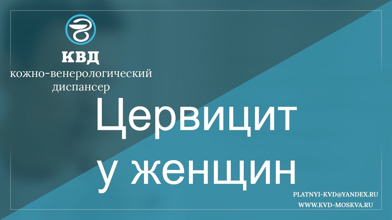 606 Цервицит у женщин