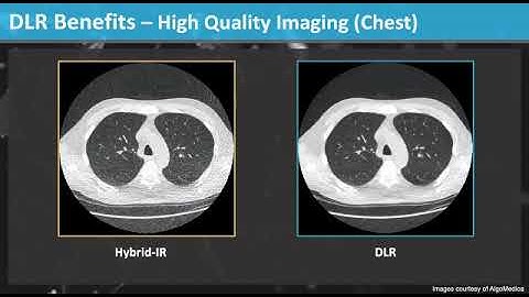 Increase Productivity and Clinical Decision Support through Deep Learning CT Image Processing