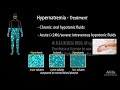 Water and Sodium Balance, Hypernatremia and Hyponatremia, Animation