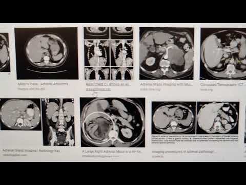 Anatomies to include in CT Chest scan / protocol
