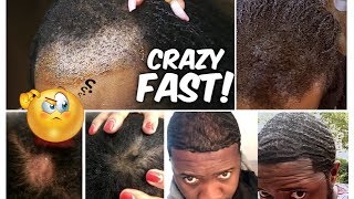 BEST Oil For FASTER Hair Growth! 🙌🏽 Your Hair will GROW like Crazy!!!