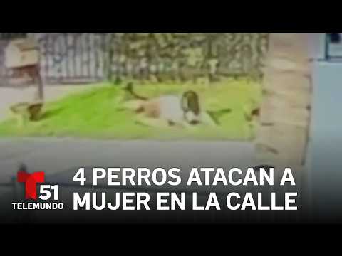 Investigation underway into dog attack on woman