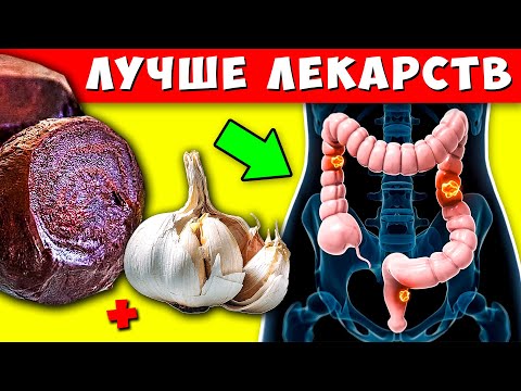 Ешьте Свеклу С Чесноком Каждый День И Смотрите, Что С Вами Случится...