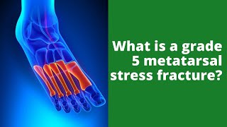 What is a grade 5 metatarsal stress fracture?