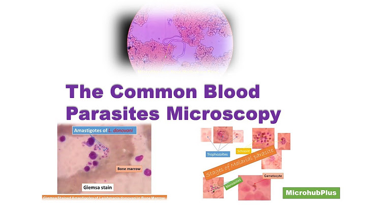 Blood stages of the parasite là giai đoạn gì năm 2024