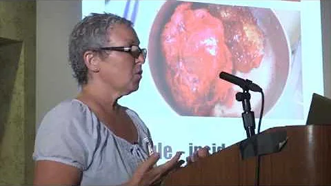 Terri McGregor speaks at the  Breast Implant Awareness   Conference 2016