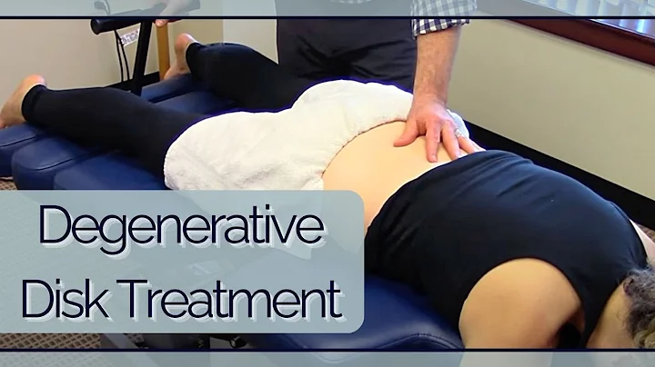 Degenerative Disc Chiropractic Treatment