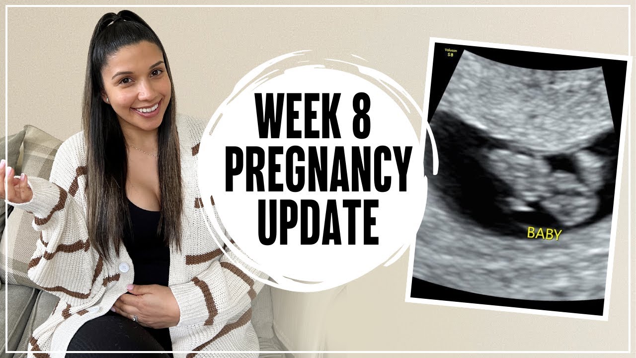 week-8-pregnancy-update-midwife-appointment-symptoms-morning