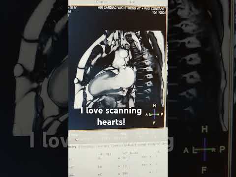 MRI Cardiac Exam