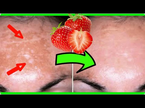 IF YOU HAVE BROWN SUN SPOT ON YOUR FACE, WIPE IT WITH A STRAWBERRY MASK - ANTI AGING - Skin Care